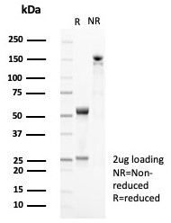 SDS-PAGE analysis of purified, BSA-free CD35 antibody (clone CR1/8282R) as confirmation of integrity and purity.