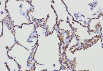 CD34 Antibody Lung IHC HPCA1/8333R. Immunohistochemistry analysis of CD34 expression in FFPE human lung tissue using an Endothelial Cell Marker Antibody, clone HPCA1/8333R, demonstrates membranous HRP-DAB brown staining in vascular endothelial cells lining alveolar capillaries and small vessels, outlining delicate microvascular networks within alveolar septa, while pneumocytes remain largely negative. The staining pattern supports clear identification of endothelial cells and visualization of pulmonary microvascular architecture. HIER: boil tissue sections in pH 9 10mM Tris with 1mM EDTA for 20 min and allow to cool before testing.