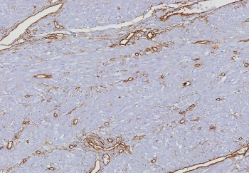 CD34 Antibody Uterus IHC HPCA1/8333R. Immunohistochemistry analysis of CD34 expression in FFPE human uterus tissue using an Endothelial Cell Marker Antibody, clone HPCA1/8333R, demonstrates membranous HRP-DAB brown staining in vascular endothelial cells outlining small vessels and capillary networks within the endometrial stroma and myometrial tissue, while surrounding stromal and smooth muscle cells remain largely negative. The staining pattern supports clear identification of endothelial cells and visualization of uterine vascular architecture. HIER: boil tissue sections in pH 9 10mM Tris with 1mM EDTA for 20 min and allow to cool before testing.