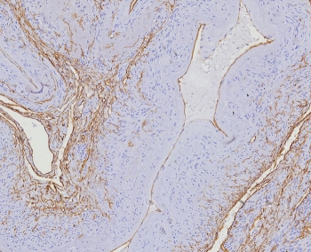 CD34 Antibody Uterus IHC HPCA1/8353R. Immunohistochemistry analysis of CD34 expression in FFPE human uterus tissue using a Vascular Marker Antibody, clone HPCA1/8353R, demonstrates membranous HRP-DAB brown staining in vascular endothelial cells outlining branching vessels and interconnected microvascular networks within the stromal and myometrial compartments, while surrounding smooth muscle and stromal cells remain largely negative. The staining pattern supports clear visualization of vascular structures and mapping of uterine vascular architecture. HIER: boil tissue sections in pH 9 10mM Tris with 1mM EDTA for 20 min and allow to cool before testing.