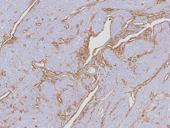 CD34 Antibody Uterus IHC HPCA1/8353R. Immunohistochemistry analysis of CD34 expression in FFPE human uterus tissue using a Vascular Marker Antibody, clone HPCA1/8353R, reveals membranous HRP-DAB brown staining in endothelial cells forming elongated and branching vascular structures throughout the stromal and myometrial regions, while adjacent smooth muscle and stromal cells remain largely negative. The staining pattern highlights interconnected vessel networks and supports detailed visualization of uterine vascular organization. HIER: boil tissue sections in pH 9 10mM Tris with 1mM EDTA for 20 min and allow to cool before testing.