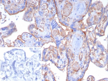 CD141 Antibody. Immunohistochemistry analysis of Thrombomodulin / CD141 expression in human placenta using clone THBD/8188R. FFPE placental tissue shows membranous HRP-DAB brown staining in trophoblastic cells and vascular endothelial structures. The inset shows the secondary antibody negative control in which PBS was used in place of the primary antibody. Antigen retrieval was performed by boiling sections in pH 9 10mM Tris buffer with 1mM EDTA for 20 minutes followed by cooling prior to staining.