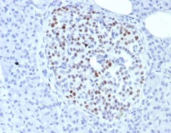 Insulinoma associated protein 1 Antibody (clone INSM1/8149R). Immunohistochemistry analysis of Insulinoma-associated protein 1 (INSM1) in formalin-fixed, paraffin-embedded human pancreas tissue using Insulinoma associated protein 1 antibody (clone INSM1/8149R). Distinct nuclear HRP-DAB staining highlights INSM1-positive endocrine cells within pancreatic islets, while surrounding exocrine pancreatic tissue shows minimal staining. The nuclear localization pattern is consistent with the transcription factor function of INSM1 and clearly delineates neuroendocrine cell populations within pancreatic tissue. Antigen retrieval was performed by boiling tissue sections in 10 mM Tris with 1 mM EDTA, pH 9, for 20 minutes followed by cooling prior to antibody incubation.