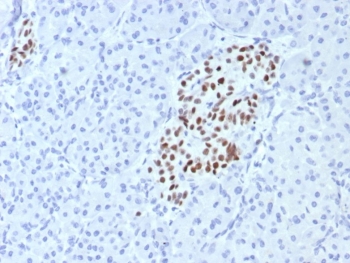 IA1 Antibody / Insulinoma-associated protein 1 (clone INSM1/7992R). Immunohistochemistry analysis of Insulinoma-associated protein 1 (INSM1) in formalin-fixed, paraffin-embedded human pancreas tissue using IA1 antibody (clone INSM1/7992R). Distinct nuclear HRP-DAB staining highlights INSM1-positive endocrine cells within pancreatic islets, consistent with the nuclear localization of this neuroendocrine transcription factor. Surrounding exocrine pancreatic tissue remains largely negative, producing clear contrast between endocrine and non-endocrine compartments. Antigen retrieval was performed by boiling tissue sections in 10 mM Tris with 1 mM EDTA, pH 9, for 20 minutes followed by cooling prior to antibody incubation.