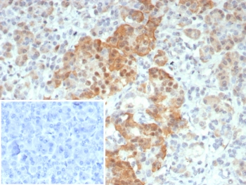 INSM1 Antibody Recombinant Rabbit MAb (clone INSM1/8122R). Immunohistochemistry of Insulinoma-associated protein 1 (INSM1) in formalin-fixed, paraffin-embedded human pancreas tissue using a recombinant rabbit monoclonal antibody. Nuclear HRP-DAB staining highlights INSM1-positive endocrine cells within pancreatic islets, consistent with the nuclear localization of this neuroendocrine transcription factor. Surrounding exocrine pancreatic tissue shows minimal staining. Antigen retrieval was performed by boiling tissue sections in 10 mM Tris with 1 mM EDTA, pH 9, for 20 minutes followed by cooling prior to antibody incubation.