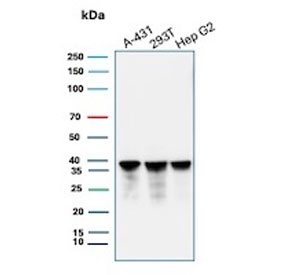 Western blot testing of human tumor cell lysates with recombinant PCNA antibody. Predicted molecular weight ~29 kDa, routinely observed at 29~36 kDa.