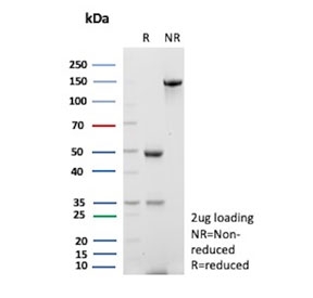 SDS-PAGE analysis of purified, BSA-free recombinant PCNA antibody (clone rPCNA/8858) as confirmation of integrity and purity.