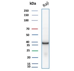 Western blot testing of human Raji cell lysate with PCNA antibody. Predicted molecular weight ~29 kDa, routinely observed at 29~36 kDa.
