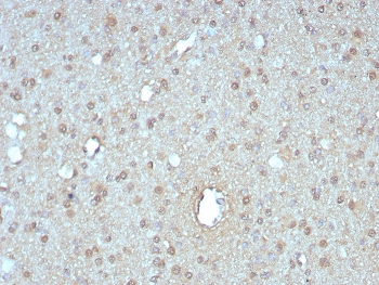 IHC staining of FFPE human pancreas tissue with GIRK2 antibody (clone KCNJ6/7558) at 2ug/ml. HIER: boil tissue sections in pH 9 10mM Tris with 1mM EDTA for 20 min and allow to cool before testing.