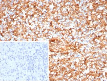 B7RP-1 Antibody Human Spleen IHC. Immunohistochemistry analysis of FFPE human spleen tissue stained with clone ICOSL/7700. Immune cell populations within splenic white pulp regions display strong membranous and cytoplasmic HRP-DAB brown staining consistent with expression of B7-related protein 1 / ICOSLG on antigen-presenting and activated immune cell populations involved in adaptive immune costimulation signaling. The inset image shows a PBS-only negative control processed without primary antibody, confirming minimal non-specific background staining. HIER: boil tissue sections in pH 9 10mM Tris with 1mM EDTA for 20 min and allow to cool before testing.