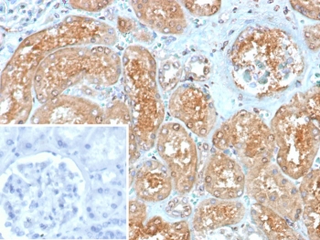 Myxovirus Resistance Protein 1 Antibody Human Kidney IHC. Immunohistochemical staining of FFPE human kidney tissue using Myxovirus Resistance Protein 1 Antibody / MX1 Antibody (clone MX1/7530) demonstrates strong granular cytoplasmic HRP-DAB brown staining throughout renal tubular epithelial cells, while glomerular structures show comparatively limited staining. MX1 is an interferon-inducible dynamin-like GTPase that functions as a key mediator of innate antiviral immunity and host defense. As a downstream effector of interferon signaling pathways, MX1 contributes to cellular antiviral responses by restricting viral replication and supporting interferon-regulated immune mechanisms. The observed tubular staining pattern is consistent with expression of MX1 in epithelial cell populations involved in innate immune surveillance and antiviral response pathways. Inset: PBS was used in place of the primary antibody as a negative control. HIER: boil tissue sections in pH 9, 10 mM Tris with 1 mM EDTA for 20 minutes and allow to cool before testing.
