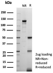 SDS-PAGE analysis of purified, BSA-free FABP3 antibody (clone FABP3/8442) as confirmation of integrity and purity.