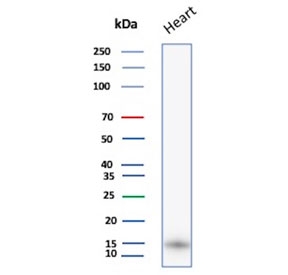 FABP3 Antibody Myocardium Tissue WB. Western blot testing of human heart lysate with FABP3 antibody. Predicted molecular weight ~14 kDa.
