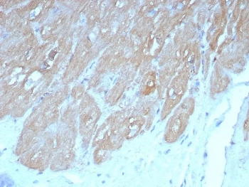 FABP3 Antibody Myocardium IHC. Immunohistochemistry staining of FFPE human heart tissue with FABP3 antibody (clone FABP3/8440). HIER: boil tissue sections in pH 9 10mM Tris with 1mM EDTA for 20 min and allow to cool before testing.