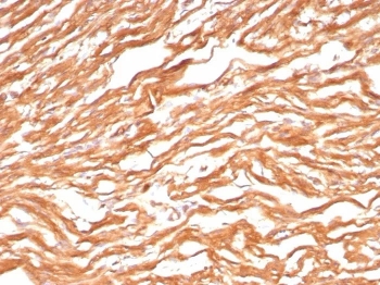 FABP3 Antibody Cardiac Tissue IHC. Immunohistochemistry staining of FFPE human heart tissue with FABP3 antibody (clone FABP3/8443). HIER: boil tissue sections in pH 9 10mM Tris with 1mM EDTA for 20 min and allow to cool before testing.