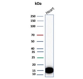H-FABP Antibody Heart WB. Western blot testing of different lots of human heart lysate with H-FABP antibody. Predicted molecular weight ~14 kDa.