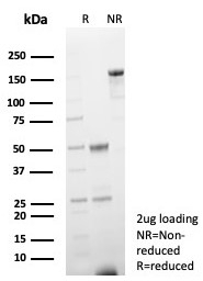 SDS-PAGE analysis of purified, BSA-free H-FABP antibody (clone rFABP3/8534) as confirmation of integrity and purity.