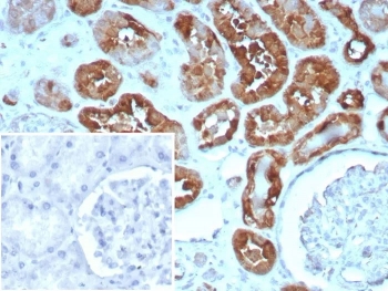 H-FABP Antibody Heart IHC. Immunohistochemistry staining of FFPE human heart tissue with H-FABP antibody (clone rFABP3/8534). HIER: boil tissue sections in pH 9 10mM Tris with 1mM EDTA for 20 min and allow to cool before testing.