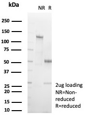SDS-PAGE analysis of purified, BSA-free Cardiac Fatty Acid Binding Protein antibody (clone FABP3/8535R) as confirmation of integrity and purity.