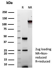 SDS-PAGE analysis of purified, BSA-free Fatty Acid Binding Protein 1 antibody (clone FABP1/8521R) as confirmation of integrity and purity.