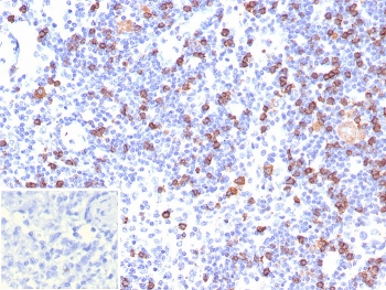 CD8A Antibody LN IHC. Immunohistochemistry analysis of CD8 alpha (CD8A) in FFPE human lymph node tissue shows membranous staining of cytotoxic T lymphocytes distributed throughout lymphoid regions, consistent with CD8-positive cells participating in antigen-driven activation and supporting detection of this T cell activation marker within the immune microenvironment. Inset: PBS used in place of primary antibody as a negative control. Heat-induced epitope retrieval was performed in pH 9 10 mM Tris with 1 mM EDTA for 20 minutes followed by cooling prior to antibody incubation.