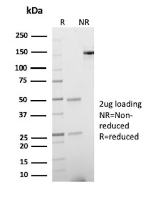 MSH6 Antibody Rabbit Monoclonal MSH6/8338R Purity Analysis by SDS-PAGE. Electrophoretic analysis of purified MSH6 Antibody Rabbit Monoclonal MSH6/8338R / G/T mismatch-binding protein under reducing (R) and non-reducing (NR) conditions with 2 ug of antibody loaded per lane. The reduced sample shows bands at approximately 50 and 25 kDa, corresponding to the antibody heavy and light chains, while the non-reduced sample shows intact antibody at approximately 150 kDa. This analysis confirms the purity and integrity of the MSH6 Antibody preparation.