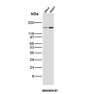 MSH6 Antibody Recombinant Mouse MAb rMSH6/8181 in HeLa and MCF7 Cancer Cells WB. Western blot testing of MSH6 Antibody Recombinant Mouse MAb rMSH6/8181 in human HeLa cervical cancer and MCF7 breast cancer cell lysates. A prominent band is detected at approximately 160 kDa in both samples, consistent with the predicted molecular weight of MSH6. This MSH6 Antibody demonstrates detection of the DNA mismatch repair protein in multiple human cancer cell lines.