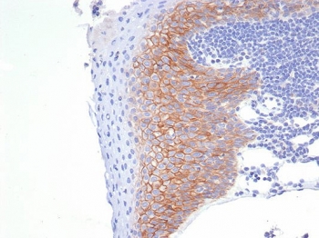 IHC staining of FFPE human tonsil tissue with CD138 antibody (clone SDC1/7177). HIER: boil tissue sections in pH 9 10mM Tris with 1mM EDTA for 20 min and allow to cool before testing.