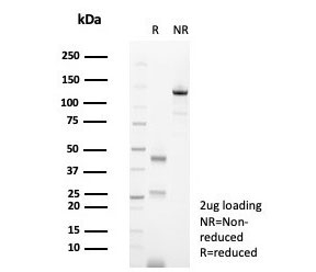 SDS-PAGE analysis of purified, BSA-free CD138 antibody (clone SDC1/7177) as confirmation of integrity and purity.