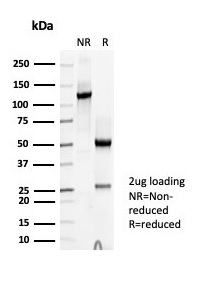 SDS-PAGE analysis of purified, BSA-free Thyroid Peroxidase antibody (clone TPO/7088R) as confirmation of integrity and purity.