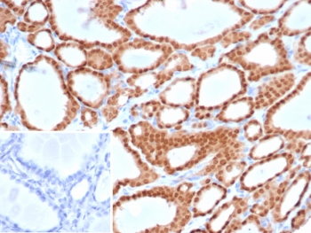 Paired box protein Pax-8 Antibody / PAX8 Antibody immunohistochemistry in human thyroid tissue showing strong nuclear HRP-DAB brown staining in follicular epithelial cells. Paired box protein Pax-8 (PAX8) expression is localized to nuclei lining thyroid follicles, with uniform nuclear positivity surrounding colloid-filled lumina and clear preservation of follicular architecture. The staining is confined to epithelial cell nuclei with minimal signal in stromal compartments, while colloid remains unstained. The nuclear pattern is consistent with transcription factor localization and highlights active epithelial lineage cells. Inset: negative control using PBS in place of primary antibody shows absence of specific staining. Heat-induced epitope retrieval was performed by boiling tissue sections in pH 9 10mM Tris with 1mM EDTA for 20 minutes followed by cooling prior to antibody incubation.