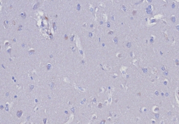 Negative control: IHC testing of FFPE human tonsil tissue with EGP40 antibody (clone EGP40/8191R) at 2ug/ml. HIER: boil tissue sections in pH 9 10mM Tris with 1mM EDTA for 20 min and allow to cool before testing.