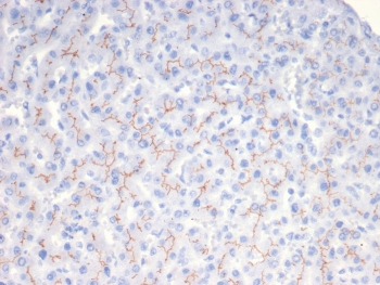 BSEP Antibody Human Liver IHC. Immunohistochemical staining of FFPE human liver tissue using BSEP Antibody / Bile Salt Export Pump Antibody at 2 ug/ml. HIER was performed in pH 9 Tris-EDTA buffer. An HRP-conjugated secondary antibody with DAB substrate was used for detection. BSEP Antibody demonstrates strong canalicular membranous staining of hepatocytes in a characteristic chicken-wire pattern, consistent with the normal localization of the bile salt export pump in liver tissue.