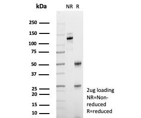 SDS-PAGE analysis of purified, BSA-free BSEP antibody (clone BSEP/7534) as confirmation of integrity and purity.