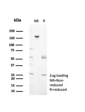 SDS-PAGE analysis of purified, BSA-free HSP60 antibody (clone HSPD1/8398R) as confirmation of integrity and purity.