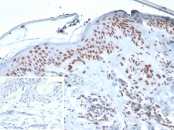 XRCC5 Antibody Human Skin Tissue IHC. Immunohistochemistry analysis of human skin tissue using XRCC5 antibody clone XRCC5/7314. Formalin-fixed, paraffin-embedded sections show strong HRP-DAB brown nuclear staining in epidermal keratinocytes, with comparatively weaker staining in the dermal compartment. The nuclear localization is consistent with XRCC5 (Ku80) function in preserving genome integrity, reflecting continuous DNA repair activity in proliferative epithelial layers exposed to environmental stress. The inset shows PBS used in place of primary antibody (secondary antibody negative control), demonstrating absence of specific staining. Hematoxylin counterstain highlights nuclei (blue), providing contrast to the XRCC5-positive nuclear staining pattern.