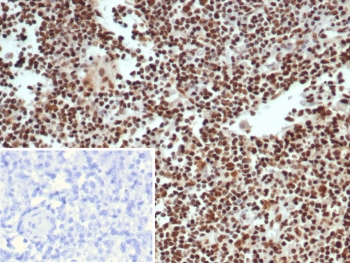 XRCC5 Antibody LN IHC. Immunohistochemistry analysis of human lymph node tissue using XRCC5 antibody clone XRCC5/7312. Formalin-fixed, paraffin-embedded sections show strong HRP-DAB brown nuclear staining throughout the lymphoid cell population, consistent with XRCC5 (Ku80) expression in cells actively engaged in DNA damage response pathways. The widespread nuclear signal reflects high cellular turnover and ongoing genomic stress handling in lymphoid tissue. The inset shows PBS used in place of primary antibody (secondary antibody negative control), demonstrating absence of specific staining. Hematoxylin counterstain highlights nuclei (blue), providing contrast to the XRCC5-positive nuclear staining pattern.