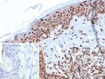 XRCC5 Antibody / DNA-PK Complex Assembly Antibody. Immunohistochemistry analysis of human skin tissue using XRCC5 antibody clone XRCC5/7313. Formalin-fixed, paraffin-embedded sections show strong HRP-DAB brown nuclear staining in epidermal keratinocytes, with comparatively lighter staining in the dermal compartment. The nuclear localization is consistent with XRCC5 (Ku80) function as a structural component of the DNA-PK complex, reflecting active assembly of DNA repair machinery in proliferative epithelial layers. The inset shows PBS used in place of primary antibody (secondary antibody negative control), demonstrating absence of specific staining. Hematoxylin counterstain highlights nuclei (blue), providing contrast to the XRCC5-positive nuclear staining pattern.