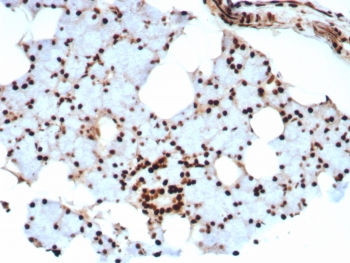 Ku80 Antibody / Chromatin-Binding Nuclear Protein Antibody. Immunohistochemistry of human salivary gland tissue using Ku80 antibody clone XRCC5/8703R. Formalin-fixed, paraffin-embedded (FFPE) sections show distinct HRP-DAB brown nuclear staining in glandular epithelial and stromal cells, consistent with chromatin-associated localization of Ku80 (XRCC5). The nuclear signal appears diffuse to punctate, reflecting DNA-binding and chromatin interaction within the nucleus. Hematoxylin counterstain highlights nuclei (blue), providing contrast to the Ku80-positive chromatin-associated staining pattern.