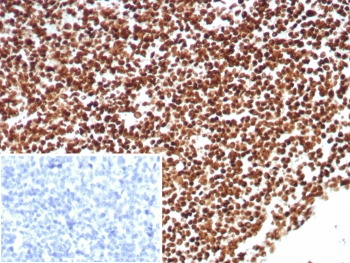 Ku80 Antibody / Chromatin-Binding Nuclear Protein Antibody. Immunohistochemistry of human tonsil tissue using Ku80 antibody clone XRCC5/8703R. Formalin-fixed, paraffin-embedded (FFPE) sections show strong HRP-DAB brown nuclear staining throughout the lymphoid cell population, consistent with chromatin-associated localization of Ku80 (XRCC5) in proliferative immune cells. The staining is widespread and predominantly nuclear, reflecting DNA-binding activity within chromatin. The inset shows PBS used in place of primary antibody (secondary antibody negative control), demonstrating absence of specific staining. Hematoxylin counterstain highlights nuclei (blue), providing clear contrast to the Ku80-positive chromatin-associated nuclear signal.