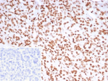 IHC staining of FFPE human pancreas tissue with PET-1 antibody (clone FEV/7311). Inset: PBS used in place of primary Ab (secondary Ab negative control). HIER: boil tissue sections in pH 9 10mM Tris with 1mM EDTA for 20 min and allow to cool before testing.