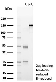 SDS-PAGE analysis of purified, BSA-free Transferrin antibody (clone TF/4794) as confirmation of integrity and purity.