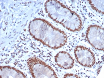 Nucleolin Antibody Mouse Monoclonal NCL/7337 immunohistochemistry analysis of human colon tissue. Formalin-fixed paraffin-embedded human colon stained with Nucleolin Antibody Mouse Monoclonal NCL/7337. HRP-DAB brown chromogenic staining highlights nuclei of epithelial cells within colonic glands, consistent with the expected nuclear and nucleolar localization of Nucleolin / NCL. HIER: boil tissue sections in pH 9 10mM Tris with 1mM EDTA for 20 minutes and allow to cool before testing.