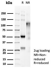 SDS-PAGE analysis of purified, BSA-free Beta Catenin (CTNNB1/6807R) as confirmation of integrity and purity.