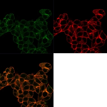 Immunofluorescent staining of PFA-fixed human MCF-7 cells with Lactotransferrin antibody (Green, clone LTF/4074); Red = Phalloidin; Yellow-Brown = superimposed.