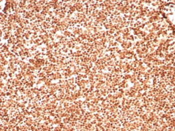 Histone H1 Antibody for IHC. Immunohistochemistry analysis of chromatin boundary-associated histone H1 expression in FFPE human lymph node tissue using Histone H1 Antibody. Nuclear HRP-DAB brown staining is observed in lymphoid cells, consistent with localization of linker histone H1 within chromatin domains and its role in chromatin boundary formation and domain insulation. Clone rHH1/8702 antibody demonstrates strong nuclear compartmentalization with minimal cytoplasmic staining, reflecting chromatin-associated distribution across organized chromatin domains.
