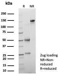 SDS-PAGE analysis of purified, BSA-free PSAP Antibody Recombinant Rabbit MAb ACPP/8409R as confirmation of integrity and purity.