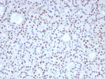 IHC staining of FFPE human parathyroid tissue with Forkhead box protein L2 antibody (clone FOXL2/8362R). HIER: boil tissue sections in pH 9 10mM Tris with 1mM EDTA for 20 min and allow to cool before testing.