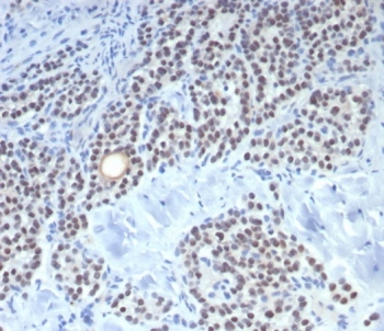 IHC staining of FFPE human parathyroid tissue with recombinant FOXL2 antibody (clone FOXL2/7989R). HIER: boil tissue sections in pH 9 10mM Tris with 1mM EDTA for 20 min and allow to cool before testing.