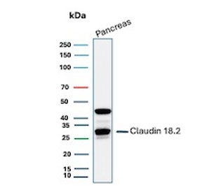 Claudin18.2 Antibody Pancreas Tissue WB. Western blot analysis of human pancreas tissue lysate using Claudin18.2 Antibody / Gastrointestinal Cancer Marker clone CLDN18.2/8559R. A major band is detected near approximately 30-35 kDa, consistent with the expected molecular weight range of Claudin18.2, a tight junction-associated transmembrane protein expressed in gastrointestinal epithelial tissues. An additional higher molecular weight band near approximately 45 kDa may represent modified, partially oligomerized, or alternatively processed Claudin18.2-associated species commonly observed with membrane-associated junctional proteins.